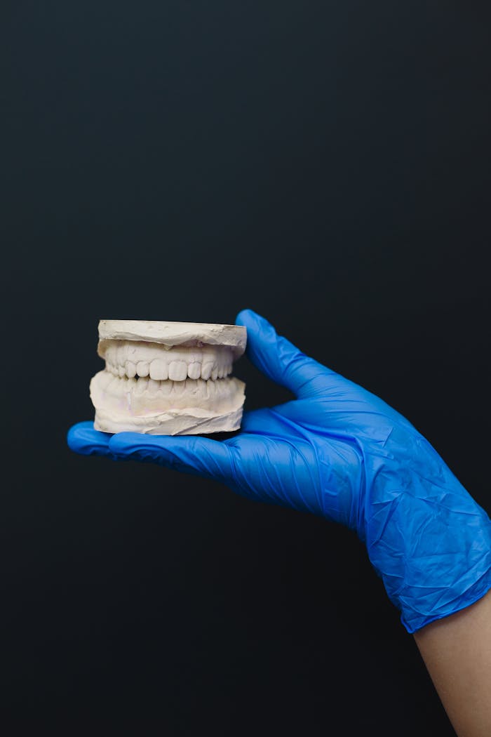 Close-up of a dental plaster model held by a gloved hand, showcasing teeth structure.