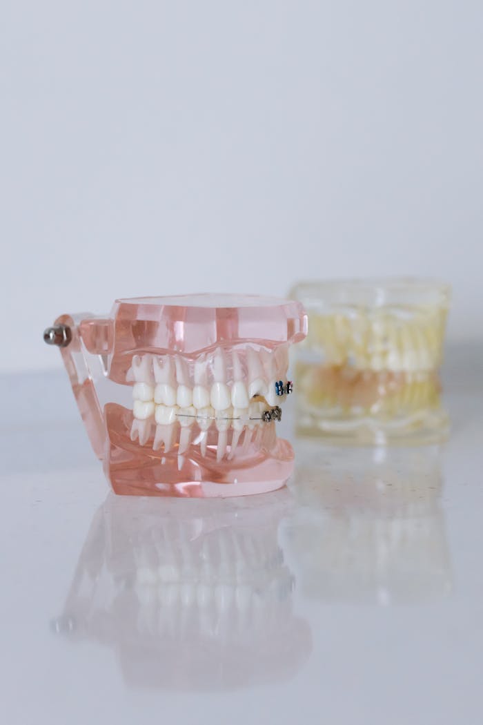 Detailed close-up of a dental model with braces, showcasing orthodontic equipment.